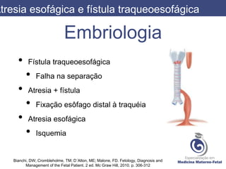 Embriologia
Atresia esofágica e fístula traqueoesofágica
Bianchi, DW; Crombleholme, TM; D´Alton, ME; Malone, FD. Fetology, Diagnosis and
Management of the Fetal Patient. 2 ed. Mc Graw Hill, 2010. p. 306-312
• Fístula traqueoesofágica
• Falha na separação
• Atresia + fístula
• Fixação esôfago distal à traquéia
• Atresia esofágica
• Isquemia
 