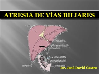 ATRESIA DE VÍAS BILIARESATRESIA DE VÍAS BILIARES
Dr. José David Castro
 