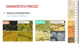 DIAGNÓSTICO PRECOZ
 ESCALA COLORIMETRICA
Matsui y Dodoriki en 1994 (Japón)
 