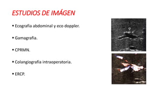 ESTUDIOS DE IMÁGEN
 Ecografia abdominal y eco doppler.
 Gamagrafia.
 CPRMN.
 Colangiografia intraoperatoria.
 ERCP.
 