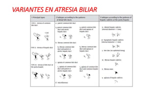 VARIANTES EN ATRESIA BILIAR
 