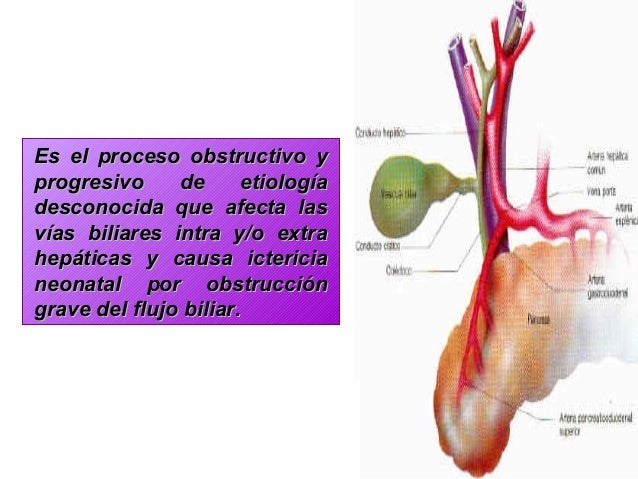 atresia de vias biliares