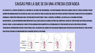 ATRESIA ESOFAGICA-EMBRIOLOGIA .pdf