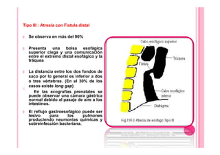 Tipo III : Atresia con Fistula distal
Se observa en más del 90%
Presenta una bolsa esofágica
superior ciega y una comunicación
entre el extremo distal esofágico y la
tráquea
La distancia entre los dos fondos de
saco por lo general es inferior a dos
o tres vértebras. (En el 30% de los
casos existe long gap)
En las ecografías prenatales se
puede observar una cámara gástrica
normal debido al pasaje de aire a los
intestinos.
El reflujo gastroesofágico puede ser
lesivo para los pulmones
produciendo neumonías químicas y
sobreinfección bacteriana.
 