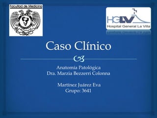 Anatomía Patológica
Dra. Marzia Bezzerri Colonna
Martínez Juárez Eva
Grupo: 3641
 