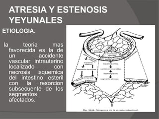 El procedimiento mas utilizado es la duodenoduodenostomia romboidea o laterolateral.