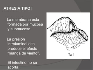 Las complicaciones posoperatorias tempranas: Fuga en la anastomosis y Sepsis local.