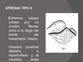 Las complicaciones a largo plazo:Reflujo alcalino, ulceración péptica, estasis duodenal con síndrome de asa ciega.