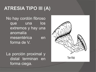 ATRESIA Y ESTENOSIS YEYUNALESETIOLOGIA. la teoria mas favorecida es la de un accidente vascular intrauterino localizado con necrosis isquemica del intestino esteril con la resorcion subsecuente de los segmentos afectados.