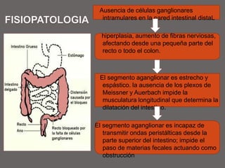 DIAGNOSTICODx. prenatal con el ultrasonido; obstrucción intestinal o diámetro de colon mayor a lo esperado con la E.G.A la Rx abdominal : Asa intestinal grande que simula “neumoperitoneo”.Enema con medio de contraste confirma el Dx.