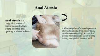 Atresi ani and Recto-vaginal fistula.pptx