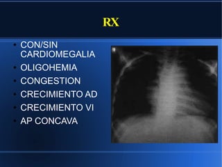 RX CON/SIN CARDIOMEGALIA OLIGOHEMIA CONGESTION CRECIMIENTO AD CRECIMIENTO VI AP CONCAVA 