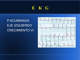 E  K  G P ACUMINADA EJE IZQUIERDO CRECIMIENTO VI 