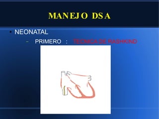 MANEJO DSA NEONATAL PRIMERO : TECNICA DE RASHKIND  