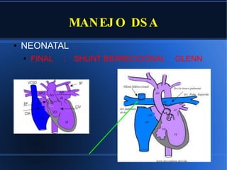 MANEJO DSA NEONATAL FINAL  :  SHUNT BIDIRECCIONAL  GLENN 