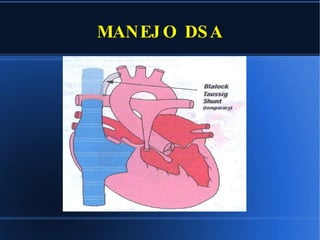 MANEJO DSA 