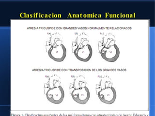 Clasificacion  Anatomica Funcional 
