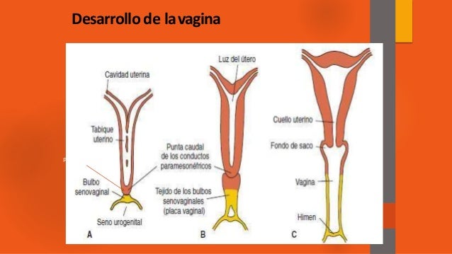 Atresia Vaginal Atresia Vaginal