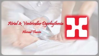 Atrial & Ventricular Dysrhythmia
Ahmad Thanin
 