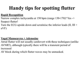 Handy tips for spotting flutter
Rapid Recognition
Narrow complex tachycardia at 150 bpm (range 130-170)? Yes ->
Suspect flutter!
Turn the ECG upside down and scrutinise the inferior leads (II, III +
aVF)
Vagal Manoeuvres + Adenosine
Atrial flutter will not usually cardiovert with these techniques (unlike
AVNRT), although typically there will be a transient period of
increased
AV block during which flutter waves may be unmasked.
 