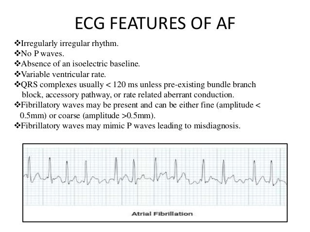 Atrial flutter vs afib - hourhac