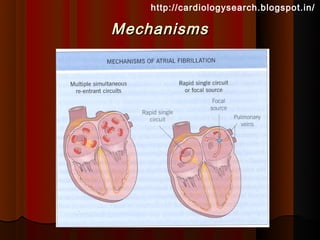http://cardiologysearch.blogspot.in/

Mechanisms
 