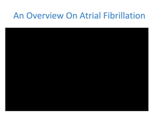An Overview On Atrial Fibrillation
 