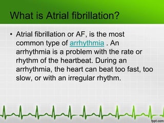 Atrial Flutter Vs Atrial Fibrillation