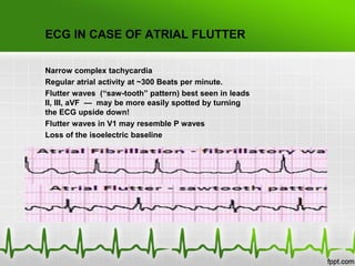HOLTER MONITORING
• Detection of atrial fibrillation may be more difficult in
people who do not have it all the time, wher...
