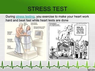 OTHER TESTS
• Chest X Ray
• A chest x ray This test can show fluid buildup in the
lungs and signs of other AF complication...