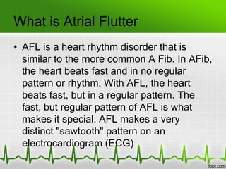 Atrial Fibrillation Vs Atrial Flutter
