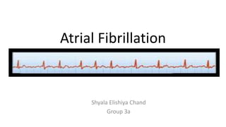 Atrial Fibrillation
Shyala Elishiya Chand
Group 3a
 