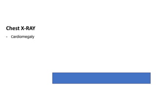 24
- Cardiomegaly
Chest X-RAY
 
