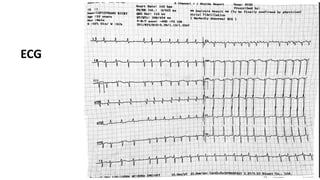 25
ECG
 