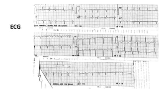 26
ECG
 