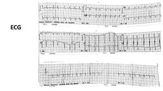 27
ECG
 