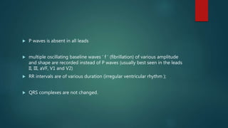  P waves is absent in all leads
 multiple oscillating baseline waves ‘ f ’ (fibrillation) of various amplitude
and shape are recorded instead of P waves (usually best seen in the leads
II, III, aVF, V1 and V2)
 RR intervals are of various duration (irregular ventricular rhythm );
 QRS complexes are not changed.
 