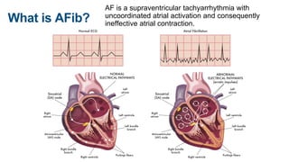 Atrial Fibrillation.pptx