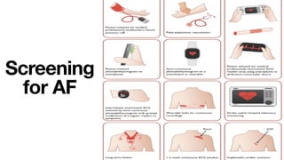 Atrial fibrillation with emphasis on management | PDF