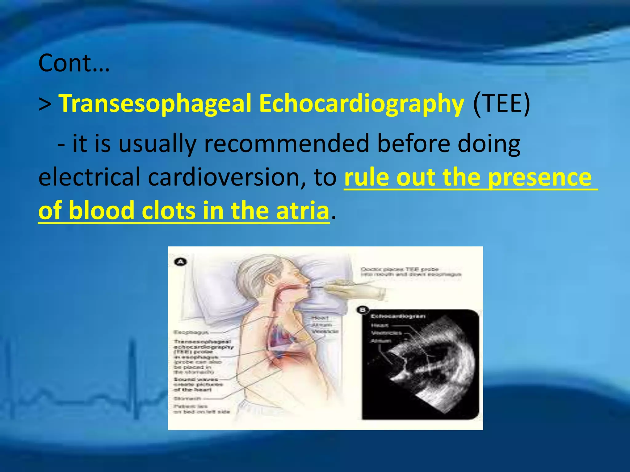 Cont… 
> Transesophageal Echocardiography )TEE) 
- it is usually recommended before doing 
electrical cardioversion, to rule out the presence 
of blood clots in the atria. 
 