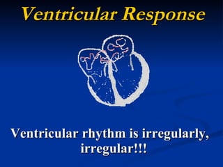Ventricular Response Ventricular rhythm is irregularly, irregular!!! 