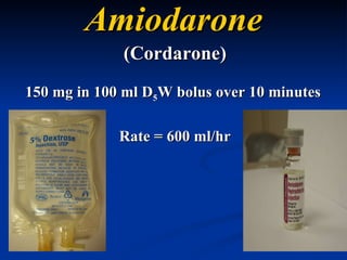 Amiodarone (Cordarone) 150 mg in 100 ml D 5 W bolus over 10 minutes  Rate = 600 ml/hr 