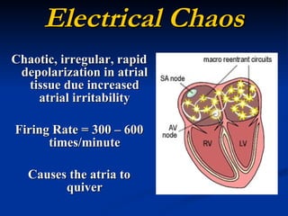 Electrical Chaos Chaotic, irregular, rapid depolarization in atrial tissue due increased atrial irritability Firing Rate = 300 – 600 times/minute Causes the atria to quiver 