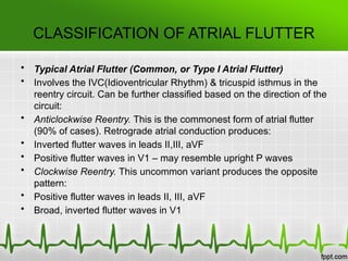 Inverted A Flutter Atrial fibrillation & Atrial flutter.pptx