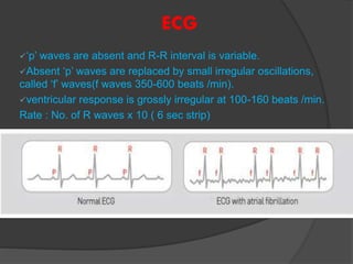 ECG
‘p’ waves are absent and R-R interval is variable.
Absent ‘p’ waves are replaced by small irregular oscillations,
called ‘f’ waves(f waves 350-600 beats /min).
ventricular response is grossly irregular at 100-160 beats /min.
Rate : No. of R waves x 10 ( 6 sec strip)
 