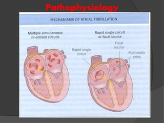 Pathophysiology
 