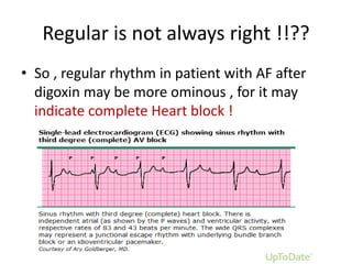 Regular is not always right !!??
• So , regular rhythm in patient with AF after
digoxin may be more ominous , for it may
indicate complete Heart block !

 