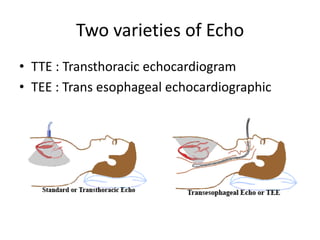 Two varieties of Echo
• TTE : Transthoracic echocardiogram
• TEE : Trans esophageal echocardiographic

 