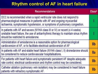 Rhythm control of AF in heart failure
 