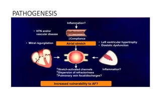 PATHOGENESISPathophysiology of AF and comorbidities
Inflammation?
• Left ventricular hypertrophy
• Diastolic dysfunction
• Mitral regurgitation Atrial stretch
Inflammation?Stretch-activated channels
Dispersion of refractoriness
Pulmonary vein focal/discharges?
Increased vulnerability to AF?
Compliance
• HTN and/or
vascular disease
 